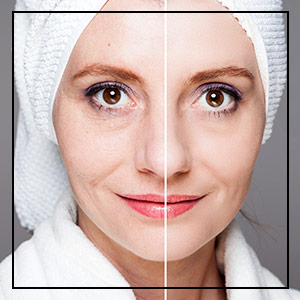 Before and After Photos for Contour Medical Spa in Northridge, Los Angeles, CA