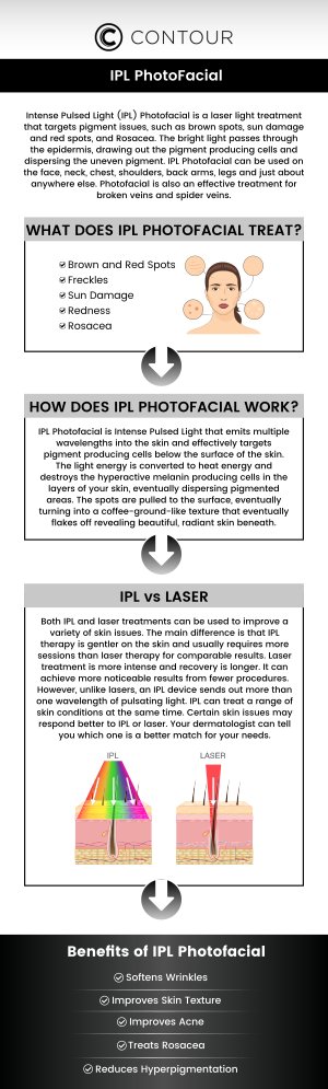 IPL (Intense Pulsed Light) treatments are designed to improve your skin's appearance by addressing sun damage, redness, and age spots. The cost of IPL (Intense Pulsed Light) treatments typically ranges from $200 to $500 per session. The cost of IPL can vary depending on the treatment area and the number of sessions needed. At Contour Medical Spa, our professional team will assess your individual needs and provide a customized treatment plan, ensuring that you receive the best possible care and results. For more information, contact us or book an appointment online. We are conveniently located at 18641 Devonshire Street Northridge, CA 91324. IPL (Intense Pulsed Light) treatments are designed to improve your skin's appearance by addressing sun damage, redness, and age spots. The cost of IPL (Intense Pulsed Light) treatments typically ranges from $200 to $500 per session. The cost of IPL can vary depending on the treatment area and the number of sessions needed. At Contour Medical Spa, our professional team will assess your individual needs and provide a customized treatment plan, ensuring that you receive the best possible care and results. For more information, contact us or book an appointment online. We are conveniently located at 18641 Devonshire Street Northridge, CA 91324.