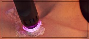Dermal Body Polishing by Glo2 Near Me in Northridge, Los Angeles, CA Dermal Body Polishing by Glo2 Near Me in Northridge, Los Angeles, CA