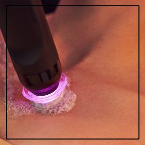 Dermal Body Polishing by Glo2 For Body Exfoliation And Prepping for Topical Tans in Northridge, Los Angeles, CA