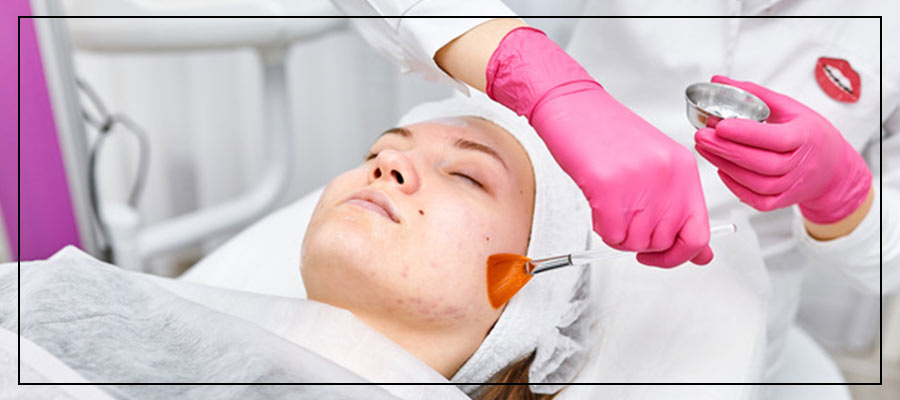 Laser Peels Specialist Near Me in Northridge, Los Angeles, CA