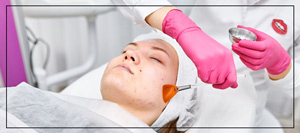 Laser Peels Specialist Near Me in Northridge, Los Angeles, CA