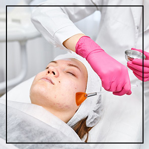 Laser Peel Specialist in Northridge, Los Angeles, CA
