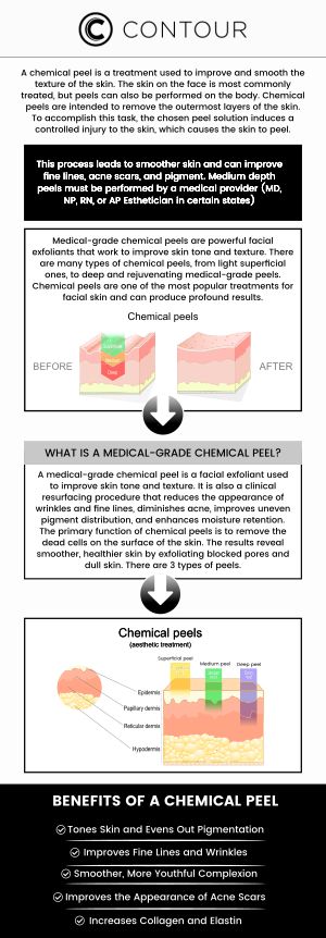 Medical grade chemical peels are a common cosmetic technique for improving the skin’s appearance to the face, neck, chest and hands. Medical grade chemical peels have been shown to significantly diminish wrinkles, fine lines, acne, scars, and sun damage, scars and texture! Choose from THREE medical grade chemical peels customized for individual needs. They can also improve skin tone and texture while increasing collagen production. Overall, medical grade chemical peels provide a non-invasive and effective method of rejuvenating the skin and achieving a more youthful, radiant appearance. Visit Contour Medical Spa to get specialized and comprehensive care. Contact us today for more information or request a consultation. We are conveniently located at 18641 Devonshire Street Northridge, CA 91324. Medical grade chemical peels are a common cosmetic technique for improving the skin’s appearance to the face, neck, chest and hands. Medical grade chemical peels have been shown to significantly diminish wrinkles, fine lines, acne, scars, and sun damage, scars and texture! Choose from THREE medical grade chemical peels customized for individual needs. They can also improve skin tone and texture while increasing collagen production. Overall, medical grade chemical peels provide a non-invasive and effective method of rejuvenating the skin and achieving a more youthful, radiant appearance. Visit Contour Medical Spa to get specialized and comprehensive care. Contact us today for more information or request a consultation. We are conveniently located at 18641 Devonshire Street Northridge, CA 91324.