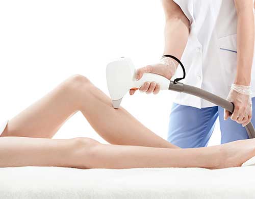 Laser Hair Removal in Northridge, Los Angeles, CA