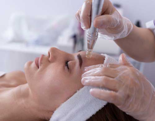 SkinPen Microneedling Treatment Specialist in Northridge, Los Angeles, CA