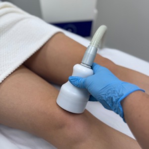 Localized Cryotherapy in Northridge, Los Angeles, CA