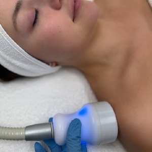 Localized Cryotherapy in Northridge, Los Angeles, CA