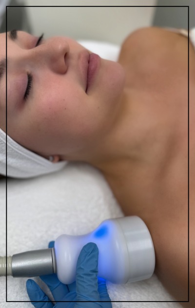 Localized Cryotherapy Near Me in Northridge, Los Angeles, CA