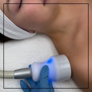 Localized Cryotherapy for Muscle Pain in Northridge, Los Angeles, CA