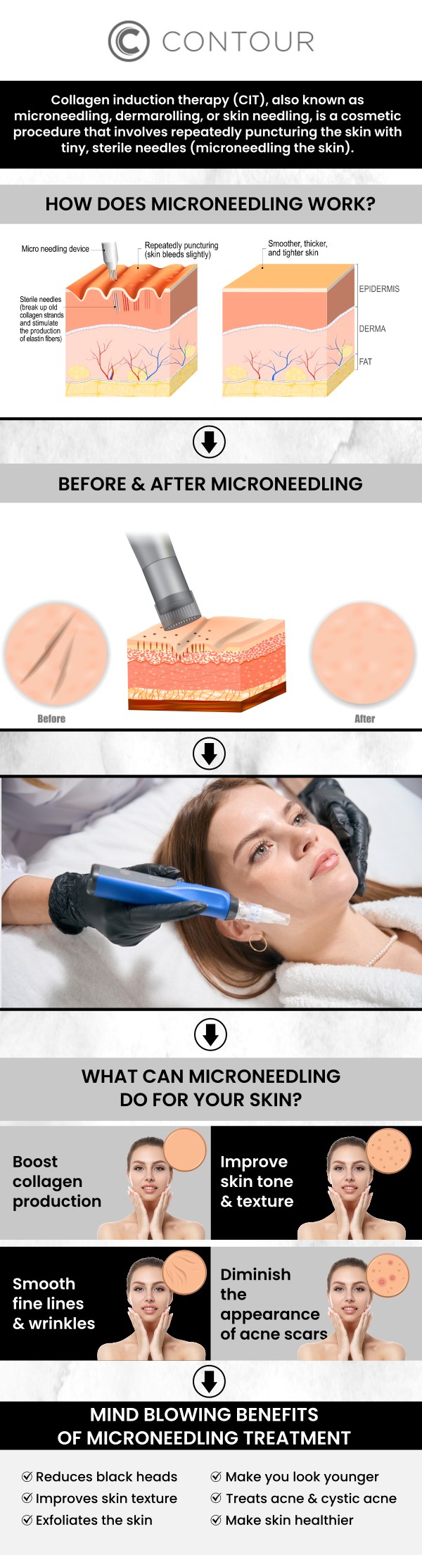 At Contour Medical Spa in Northridge, Los Angeles, we specialize in SkinPen Microneedling, an FDA-cleared, medical-grade microneedling device designed to improve the texture and appearance of your skin. Led by Cecilia Scott, RN, BSN, our SkinPen treatment stimulates collagen production, helping to reduce fine lines, acne scars, and enlarged pores, while leaving your skin smoother, firmer, and more radiant. Cecilia provides personalized, professional care tailored to your skin’s unique needs, ensuring an effective and comfortable experience. Whether you’re seeking rejuvenation or addressing specific skin concerns, SkinPen Microneedling offers a trusted solution for a refreshed, youthful glow. Contact us today for more information or request a consultation. We are conveniently located at 18641 Devonshire Street Northridge, CA 91324. At Contour Medical Spa in Northridge, Los Angeles, we specialize in SkinPen Microneedling, an FDA-cleared, medical-grade microneedling device designed to improve the texture and appearance of your skin. Led by Cecilia Scott, RN, BSN, our SkinPen treatment stimulates collagen production, helping to reduce fine lines, acne scars, and enlarged pores, while leaving your skin smoother, firmer, and more radiant. Cecilia provides personalized, professional care tailored to your skin’s unique needs, ensuring an effective and comfortable experience. Whether you’re seeking rejuvenation or addressing specific skin concerns, SkinPen Microneedling offers a trusted solution for a refreshed, youthful glow. Contact us today for more information or request a consultation. We are conveniently located at 18641 Devonshire Street Northridge, CA 91324.