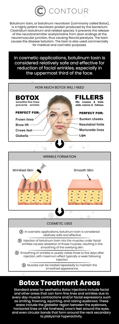 Botox cosmetic injections help smooth out fine lines and wrinkles in the forehead, crow’s feet, and frown lines by temporarily reducing muscle activity in targeted areas. This non-surgical cosmetic treatment can help create a refreshed and more youthful appearance while maintaining natural facial expressions. Botox cosmetic treatments are customized based on each patient’s aesthetic goals, allowing for a personalized approach to wrinkle reduction and facial rejuvenation. Visit Contour Medical Spa today to receive specialized and comprehensive care tailored to your needs. For more information, contact us today to learn more or request an appointment online. Our med spa is conveniently located at 18641 Devonshire Street Northridge, CA 91324.