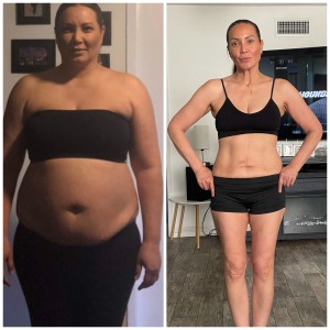 Before & After photos of Weight Loss GLP in Northridge, Los Angeles, CA