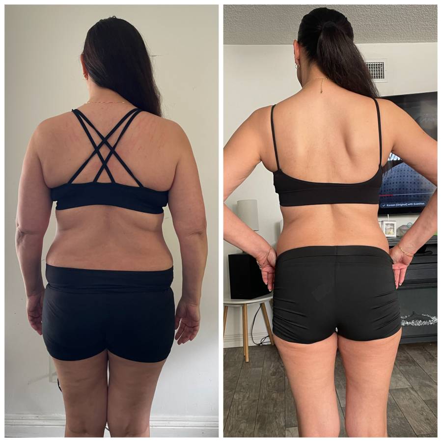 Before & After photos of Weight Loss GLP in Northridge, Los Angeles, CA