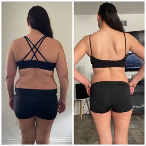 Before & After photos of Weight Loss GLP in Northridge, Los Angeles, CA